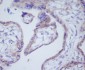Anti-DKK1 Rabbit Monoclonal Antibody
